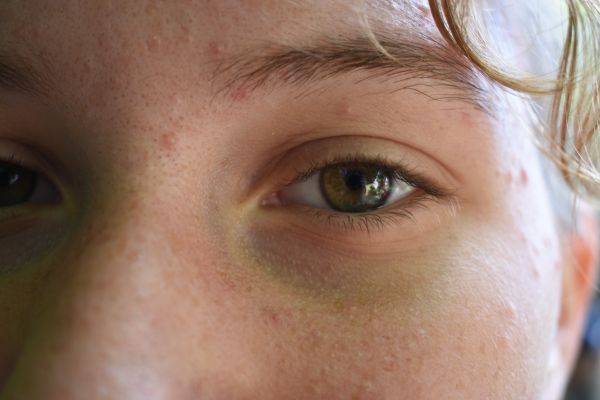 Kattints ide a teljes kép megtekintéséhez